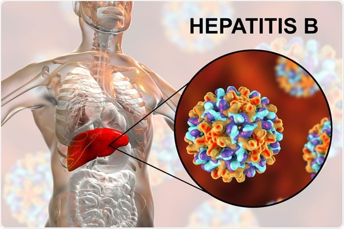 हेपेटाइटिस की दो अवस्थाएं होती हैं।
